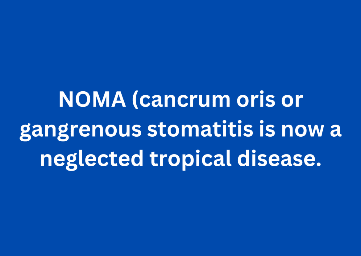 WHO officially recognizes noma as a neglected tropical disease